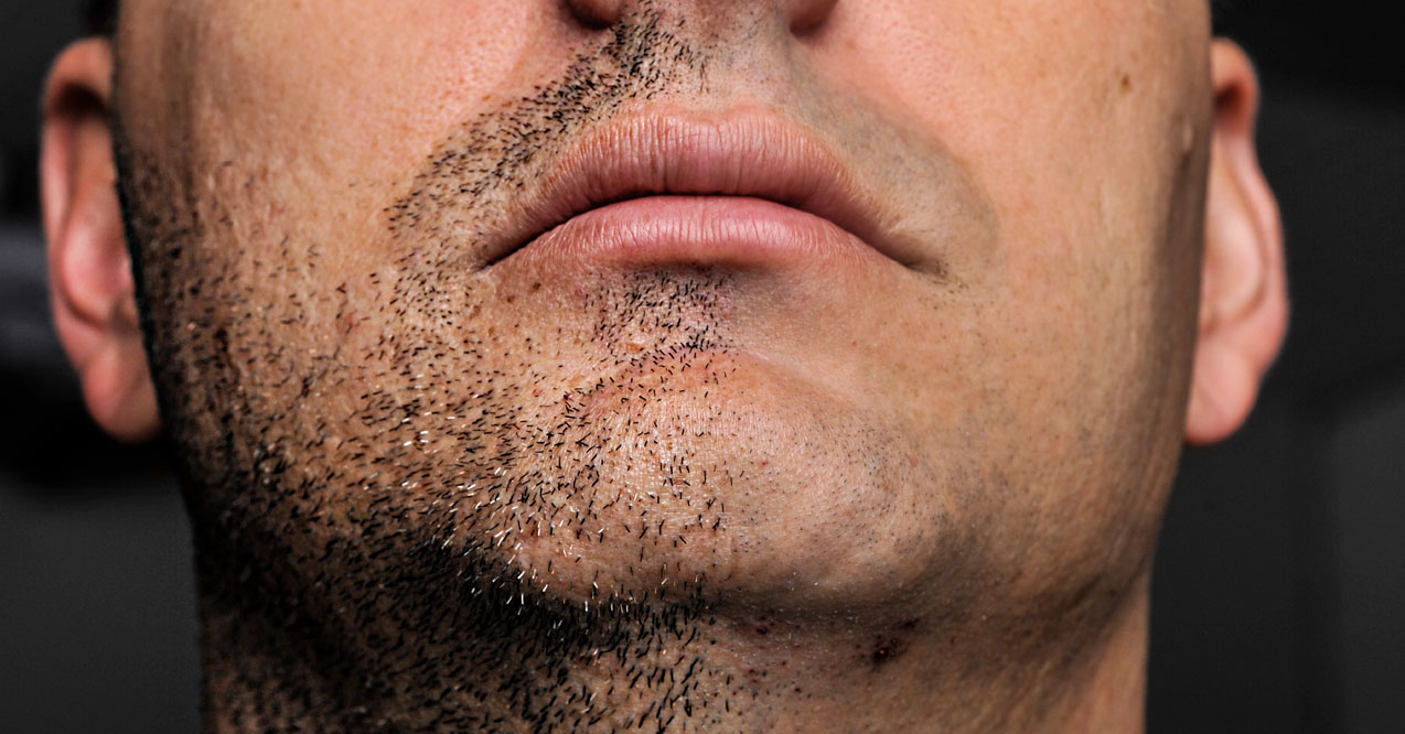 What Your Facial & Body Hair Says About You!