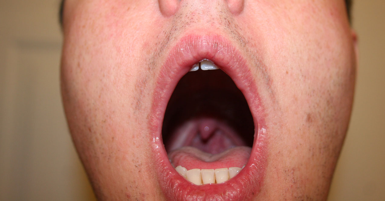 Speaking of Uvulas… Remember This?