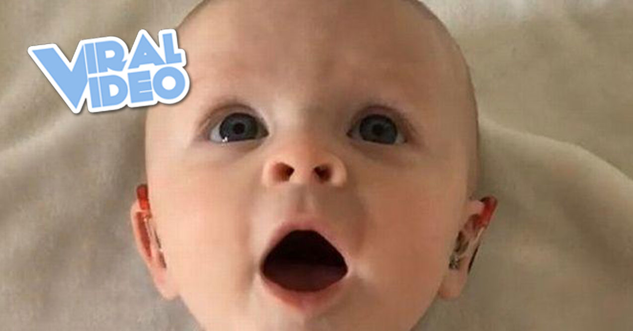 Viral Video: Baby Gets Excited With Hearing Aids